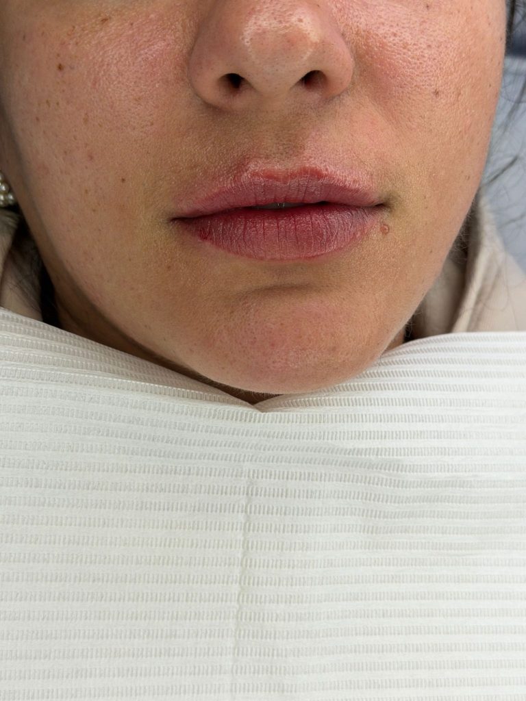 Close-up van een vrouwelijk gezicht met een neutrale uitdrukking en volle lippen.