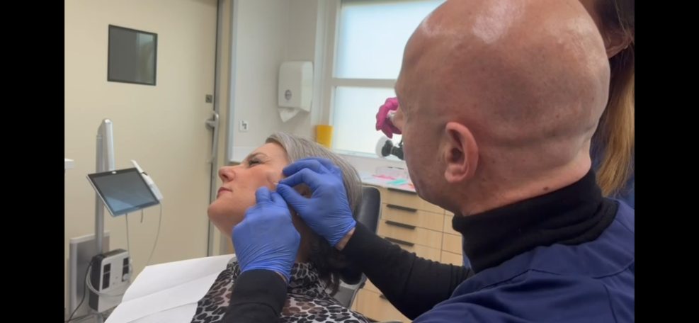 Lipfiller behandeling door arts van cosmedisch.com