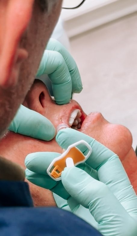 Lipfiller behandeling door arts van cosmedisch.com